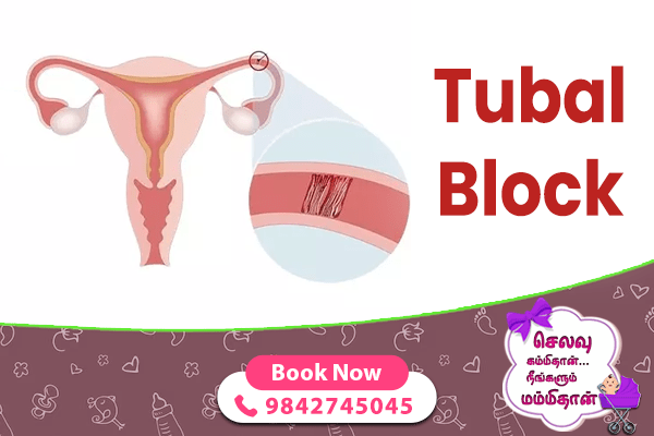 Tubal Block