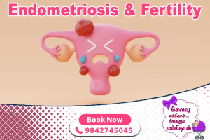 Endometriosis and Fertility