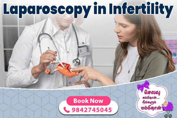 Laparoscopy in Infertility